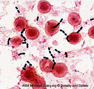 Enterococcus 