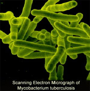 Mycobacterium tuberculosis