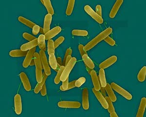 Pseudomonas aeruginosa