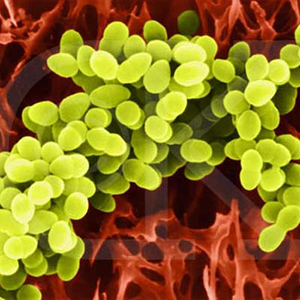 Staphylococcus aureus